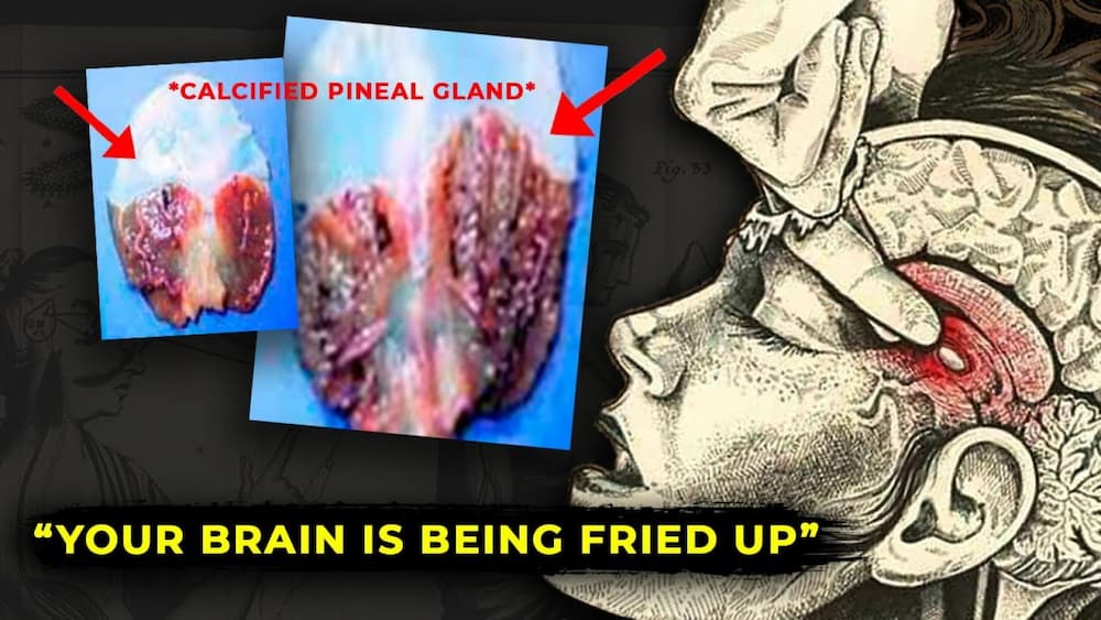 pineal-gland